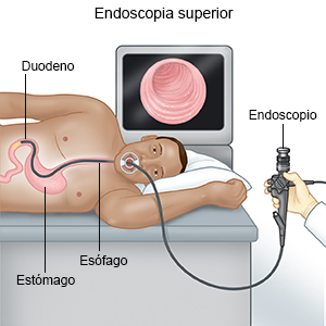 Endoscopia